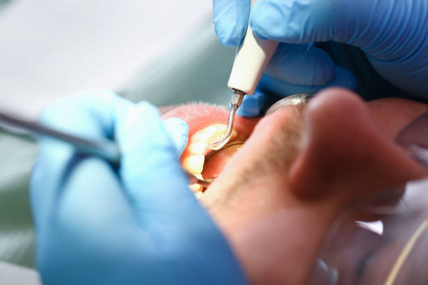 Best Knocked-Out Tooth Emergency  in Naval Academy, MD