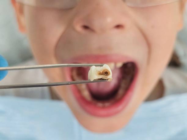Best Emergency Dentist Near Me  in Naval Academy, MD